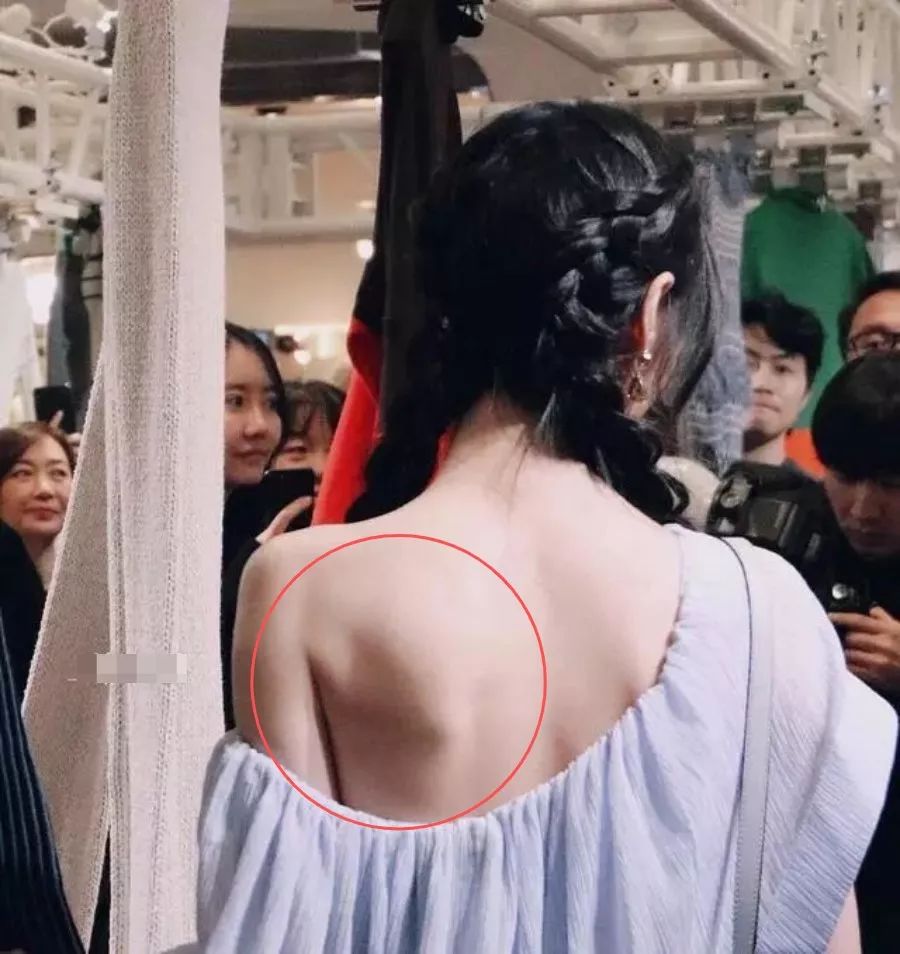 郑爽的蝴蝶背被夸艳压全场,祸害全身肌肉的病态审美还拿出来吹?_肩胛