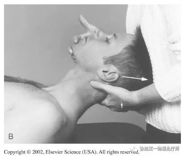 「 運動康復」頸椎失穩(cervical spine instability)