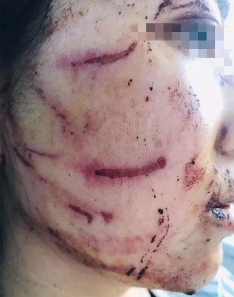 出轨就应该被暴打,被往脸上抹屎,是不是还要沉猪笼啊?