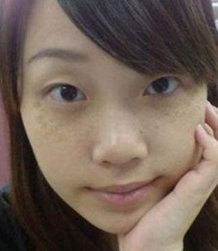 内分泌失调,黄褐斑不请自来,吃1物内调和3个方法,来补救!