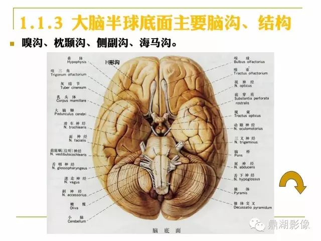 小脑解剖图mr图片