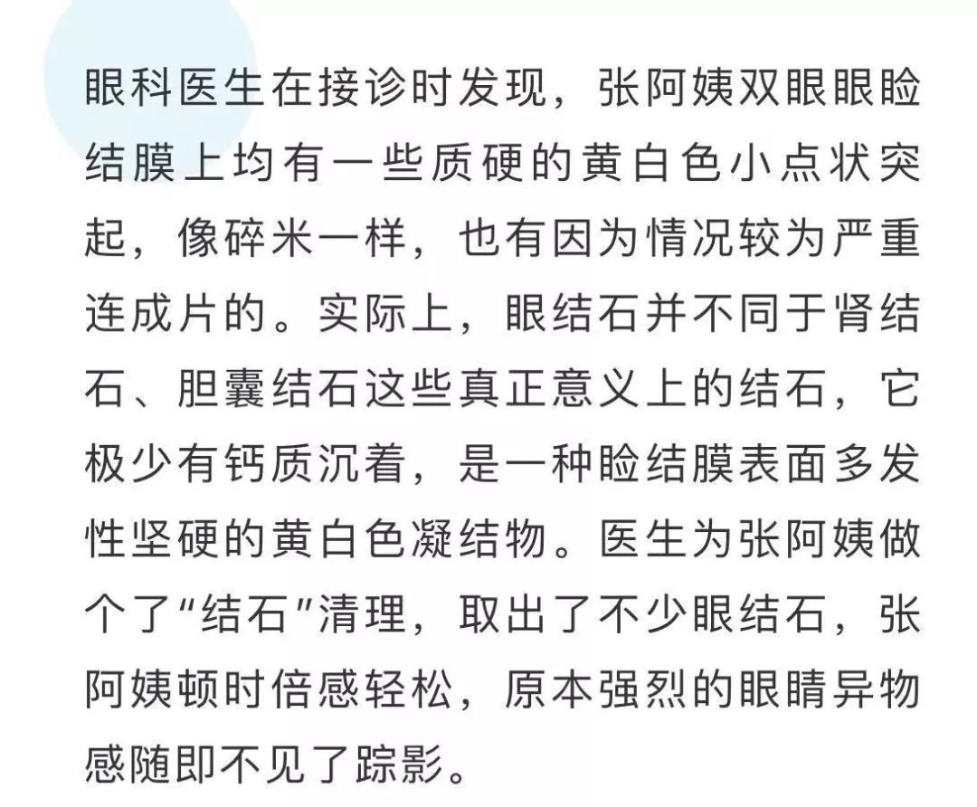 眼睛又痛又痒,以为是进了沙子,到医院一查竟是结石