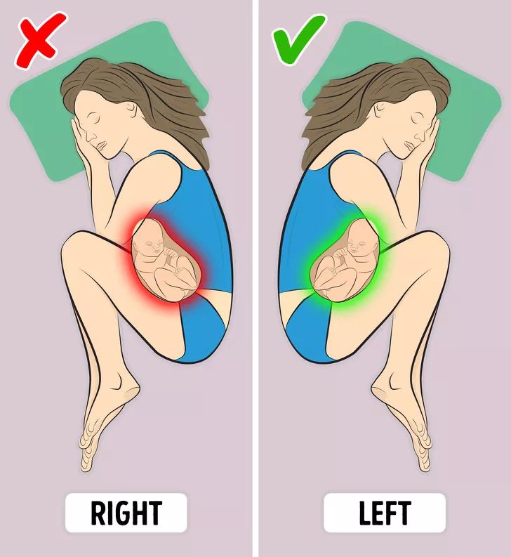 胎位不正 睡觉图片