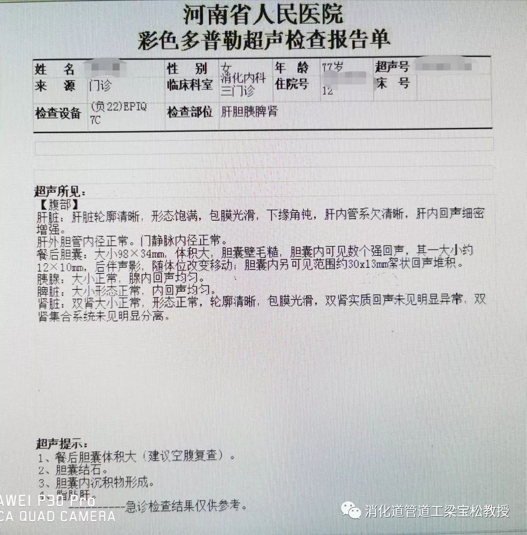 胃痛心痛还是胆痛