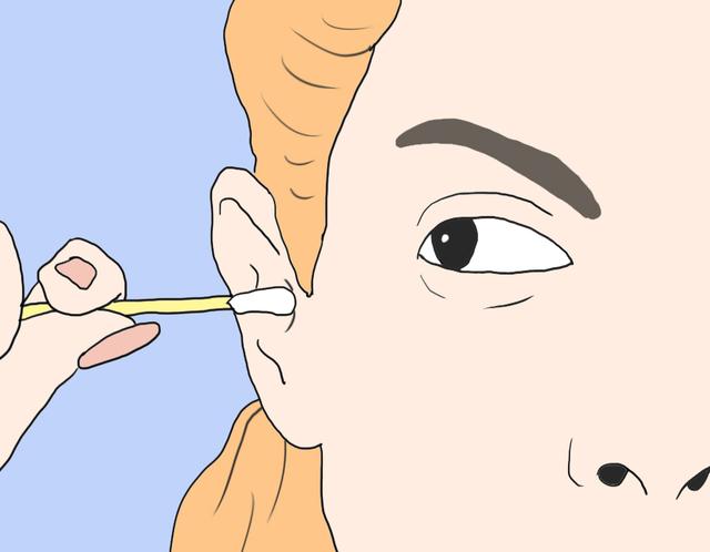 耳鼻咽喉头颈外科朱镇华教授介绍:耳屎是耳朵皮肤中耵聍腺的分泌物