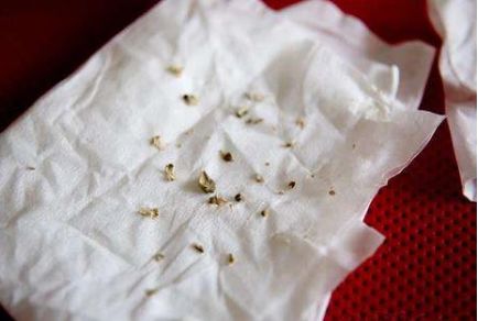 牙结石又叫牙石,由菌斑和软垢钙化而成,是一种沉积于牙面或修复体表面