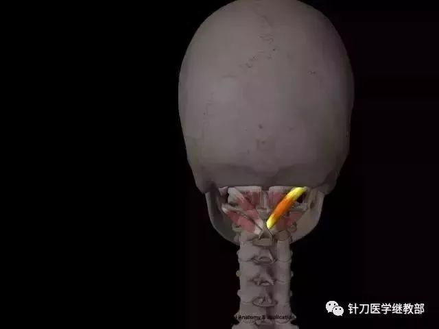 椎枕肌群你要了解的几块肌肉和自我解决办法