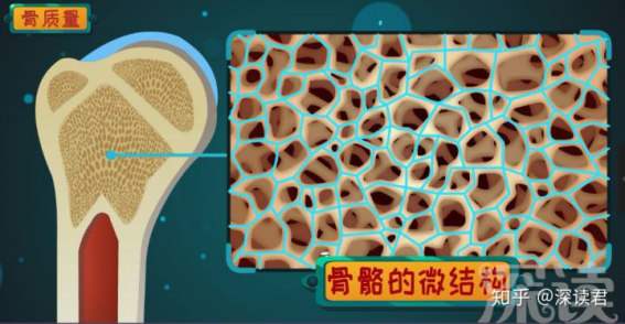 先看视频了解疾病再问诊,清楚)回到骨大厦,看看这蜂窝状的骨松质,有横