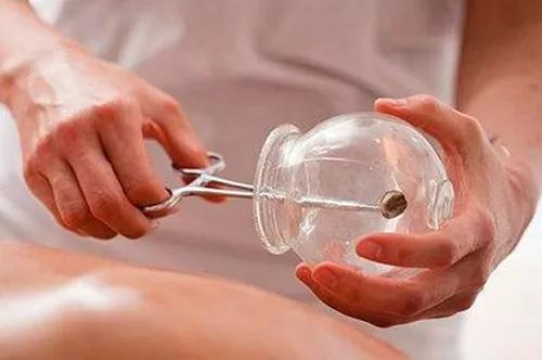 拔罐的操作规程及注意事项是你想要的干货哦