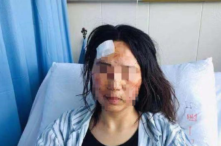 男子伙同父亲当街家暴妻子,事后却妄想和解!妻子一方:门都没有