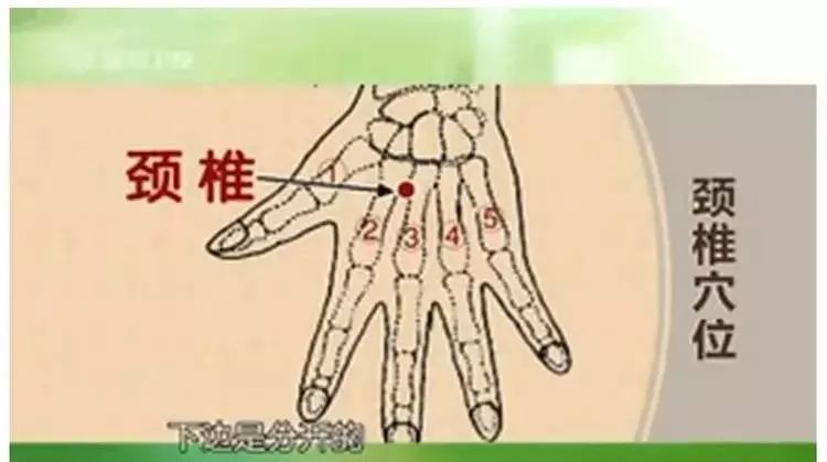 一分钟治好颈椎病腰椎病首都医科大学教授研究成果推广太神奇了真人