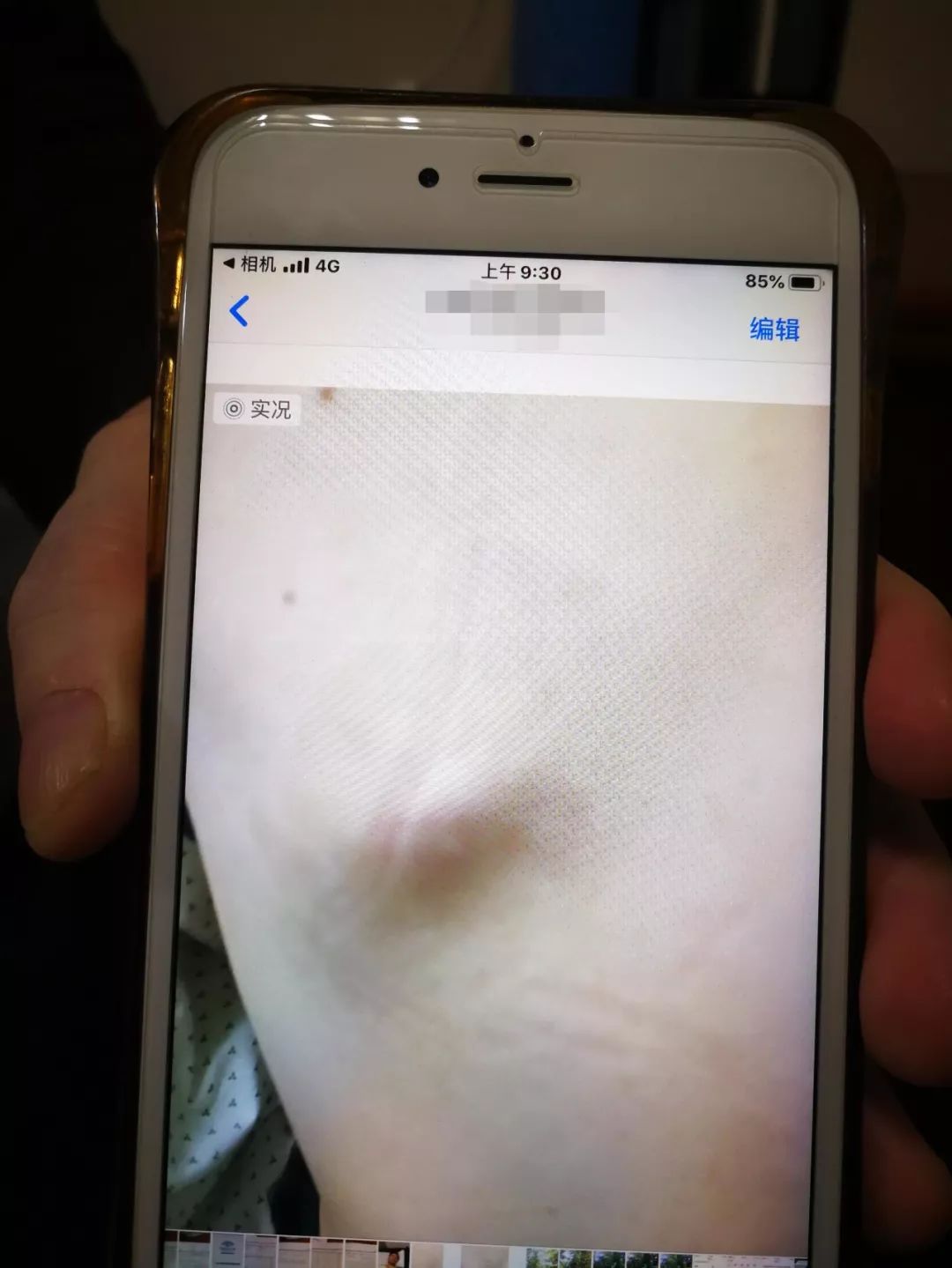 【暖医】 "等你好了,我请你吃饭"!他们陪他和"癌王"抗争的22个月