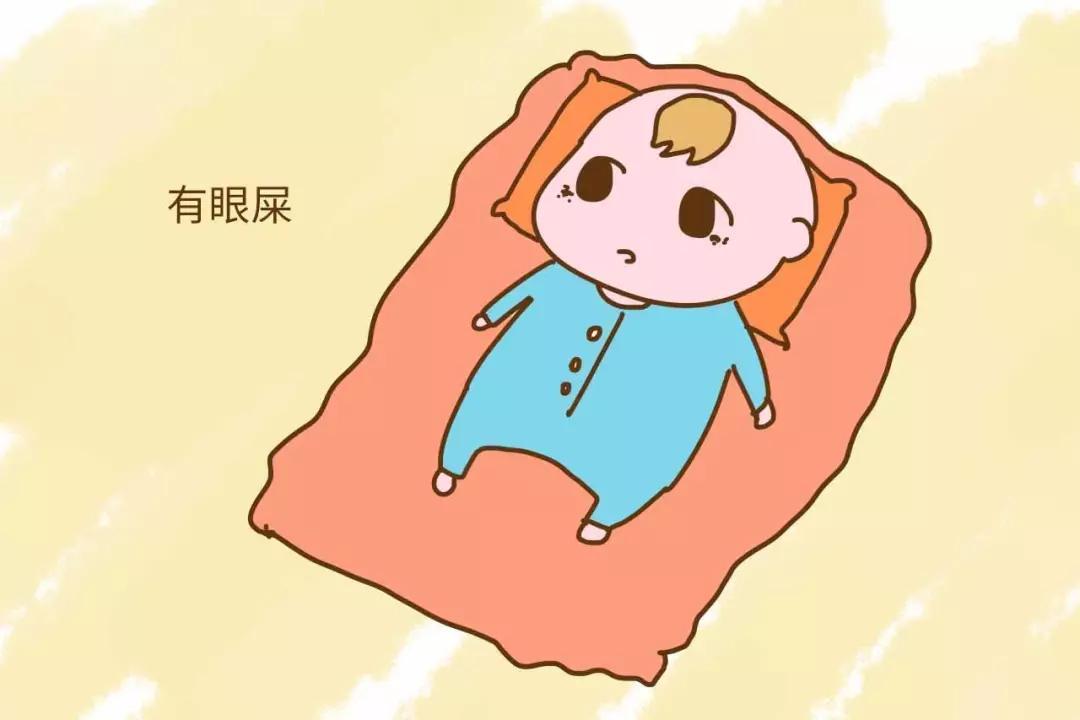 【宝宝课堂】宝宝总是眼屎多,这几个原因妈妈需了解!