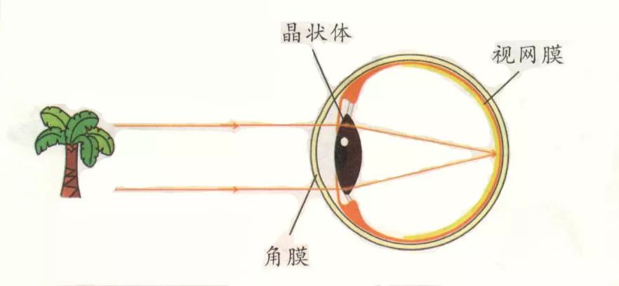 的眼睛,远处光线通过角膜和晶状体的折射会正好在视网膜上聚焦成像
