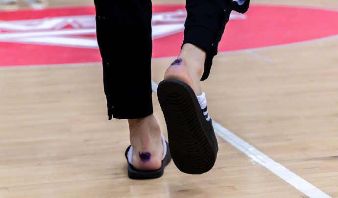 原创cba最强硬汉!可兰白克脚后全磨破,血染红袜子,训练只能穿拖鞋