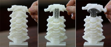 3d打印金属钛合金如何提高产量