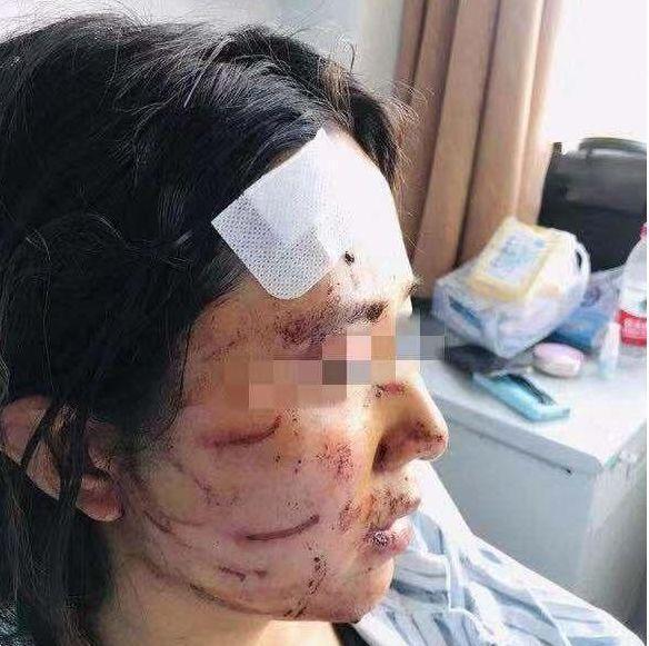 温州女子被丈夫公公暴打大便涂脸200万嫁妆换来的却是家暴