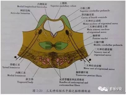 下面展示橋橫纖維的解剖圖,中腦大腦腳的皮質腦橋纖維終止於腦橋核