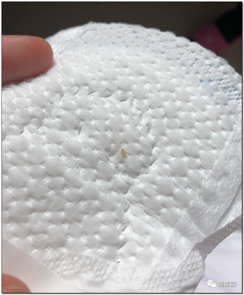 ABC卫生巾虫卵图片