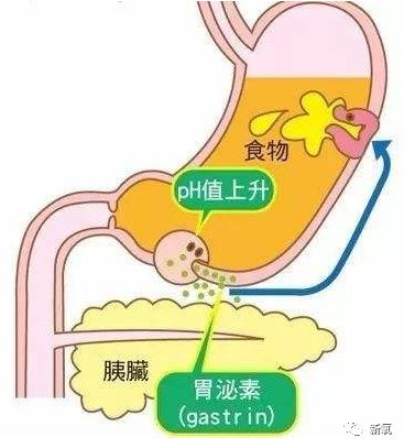 原创继宋祖儿催吐疤之后,22岁女孩为催吐把胃管吞入腹中