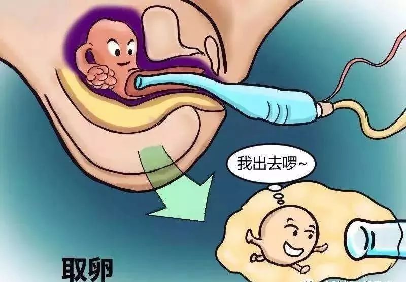 取卵會取出驚喜你曉得不