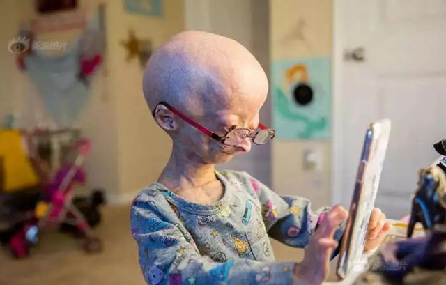 12岁的年纪80岁的容貌这个拥有1500万粉丝的女孩治愈了无数人