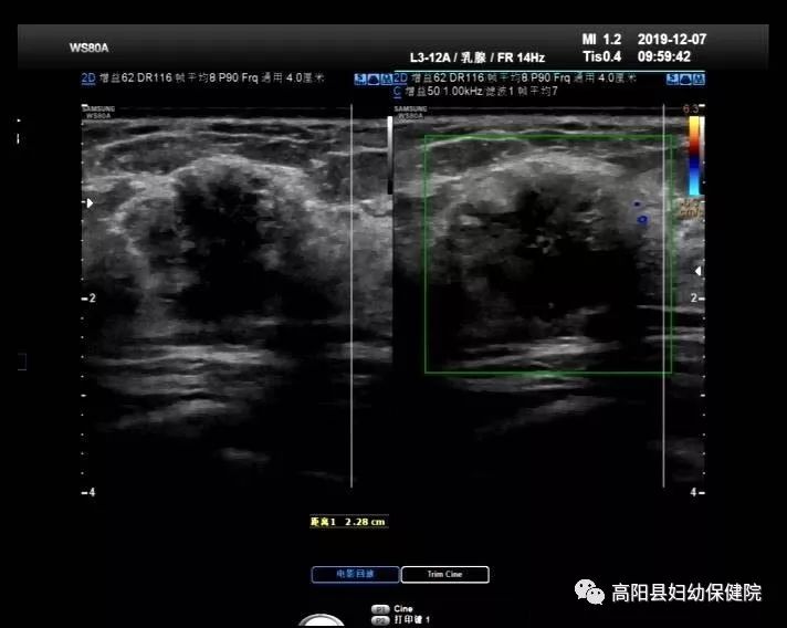 【高阳妇幼科室介绍】超声科简介