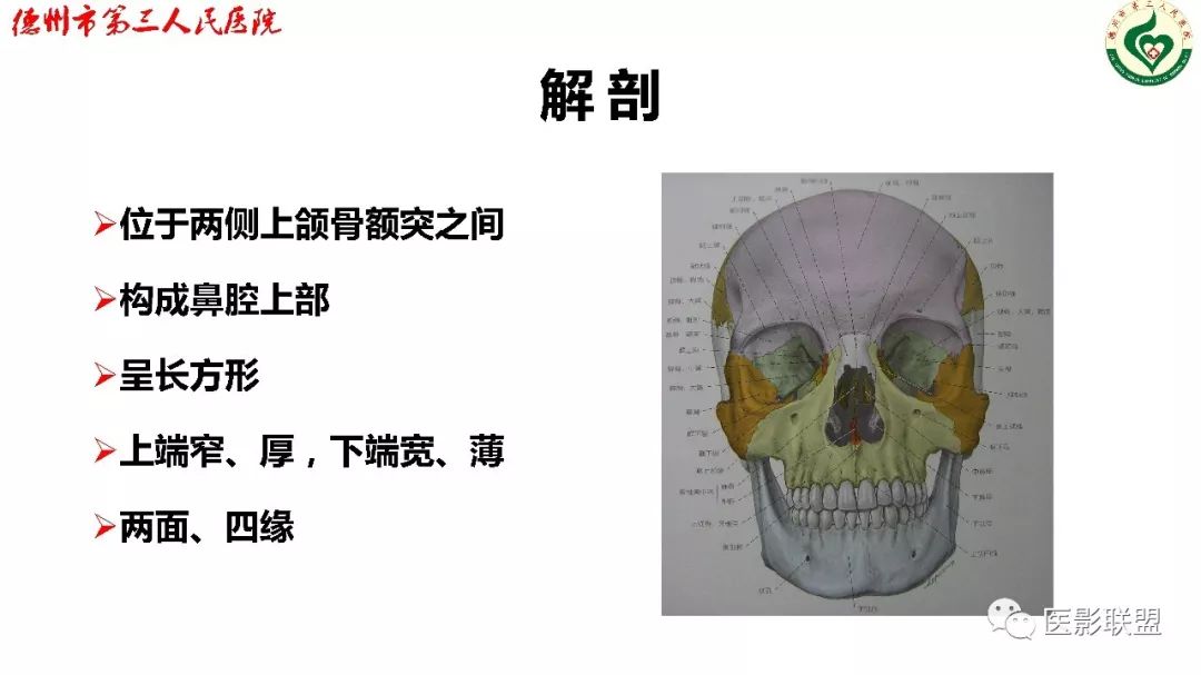 鼻骨骨折三维重建图图片