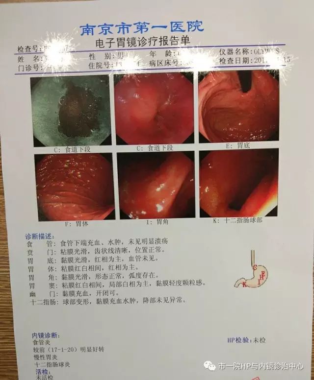胃镜检查报告单高清图片