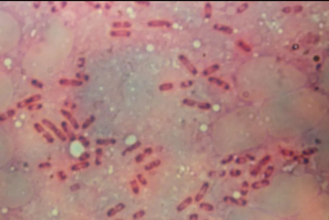 鼠疫耶尔森菌培养图片