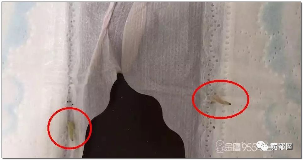 ABC卫生巾虫卵图片