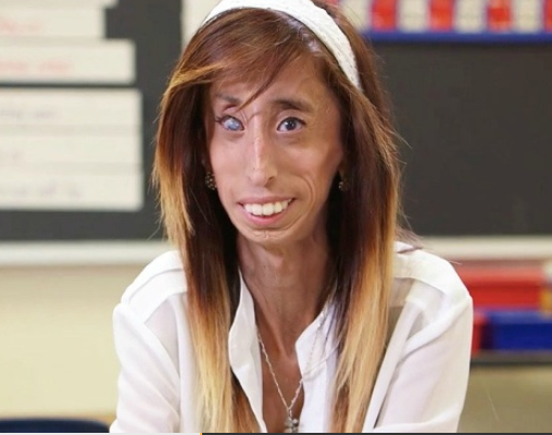 她是世界上最瘦的女人,一天吃60顿饭,体重却只有27公斤!