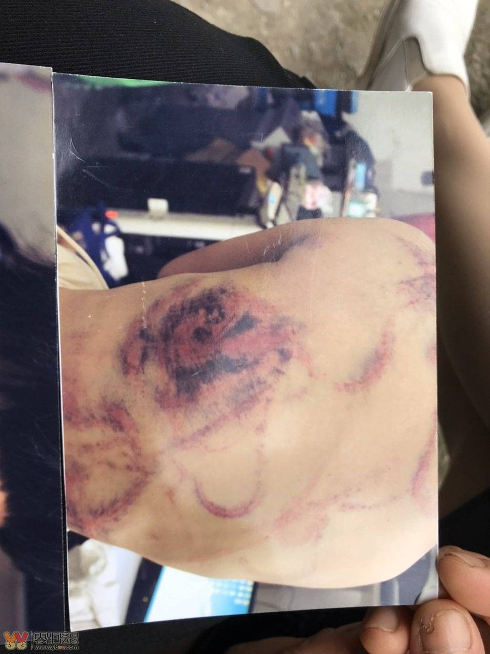 皮带和衣架毒打所致,毛某某和李某在孩子李某某被打伤前几个月已经