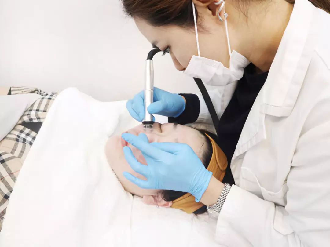 美容测评大气泡清洁针清闭口祛痘还你白净肌肤