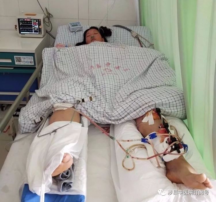 勇攀高峰涉县中医院eras团队成功救治复合创伤患者