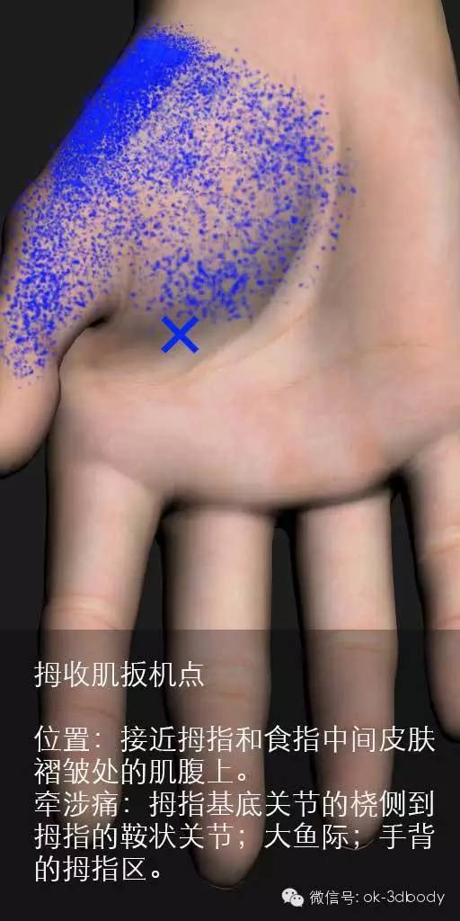 全身激痛点手册