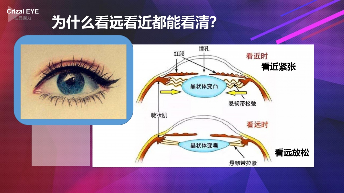 在看遠看近的時候都需要用到肌肉的 用力和放鬆,晶狀體 可以說是直接