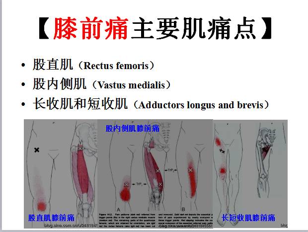 胫骨后肌激痛点图片