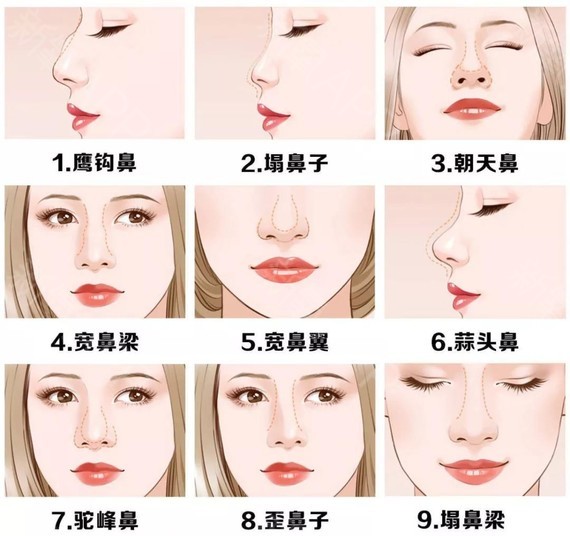 鼻子有哪些类型图片