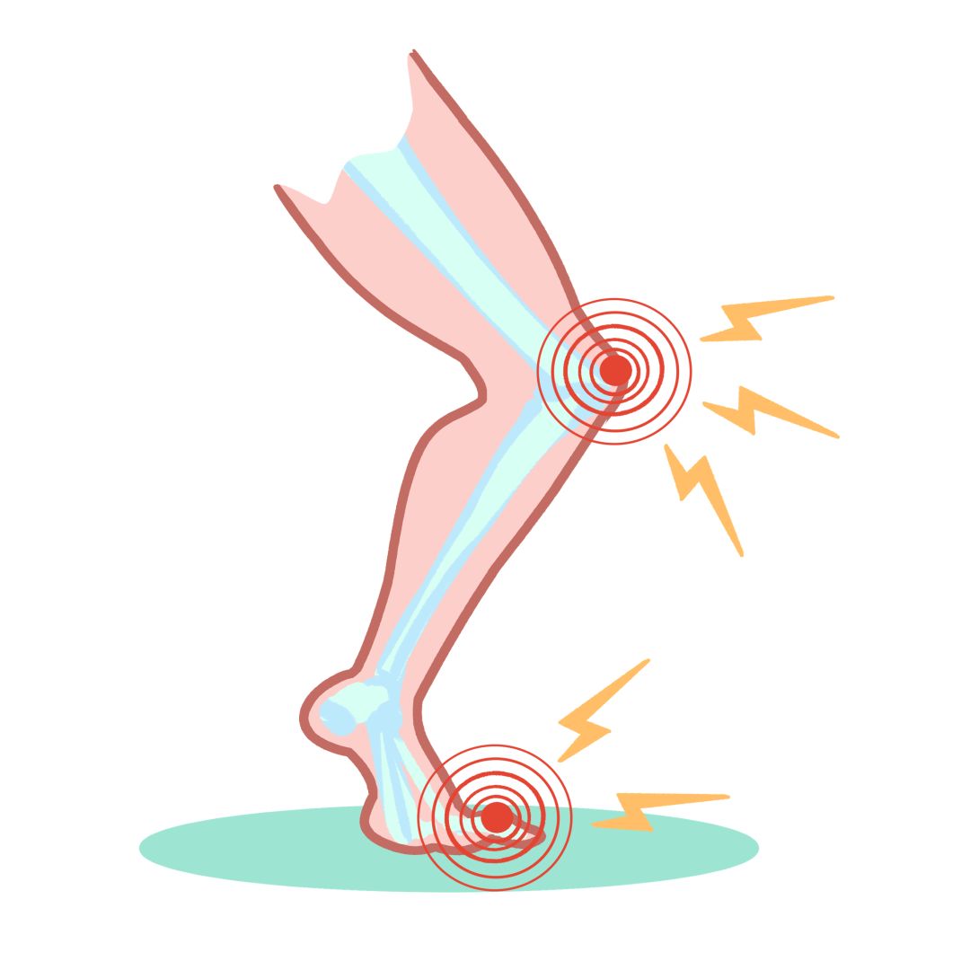 一旦发生关节移位,滑液分泌减少等情况,则将会产生关节弹响.