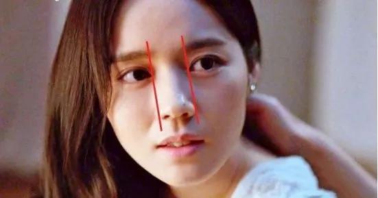 鼻翼窄小,不能过宽过厚