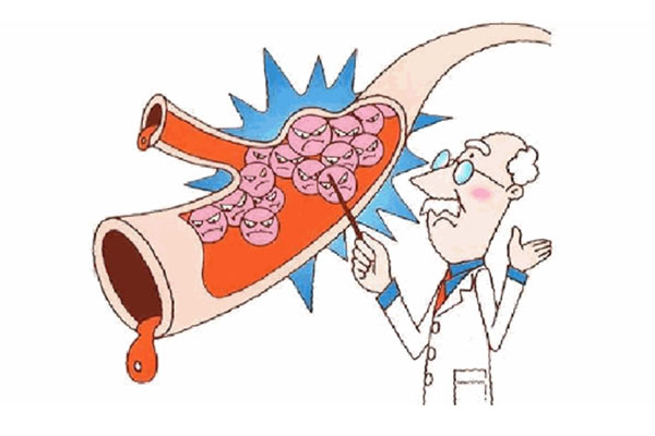 如何预防下肢静脉血栓?_患者