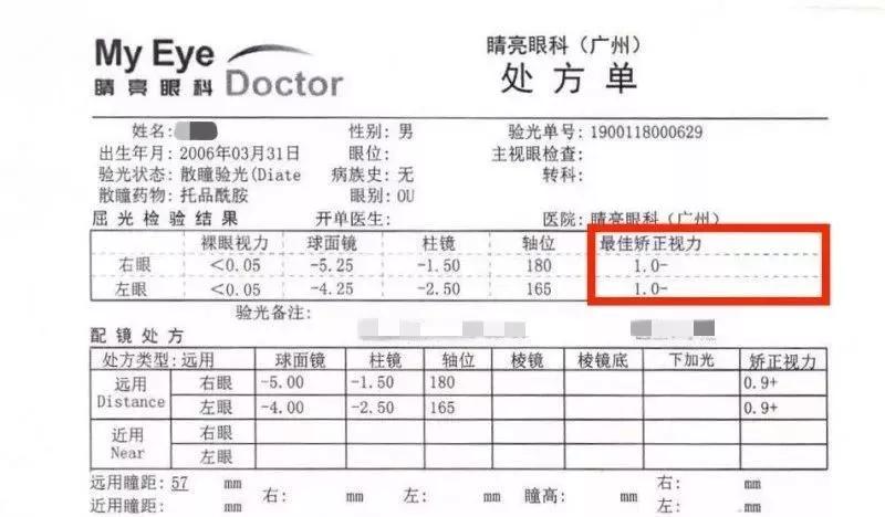 看完这篇文章我再也不想去普通眼镜店配镜了