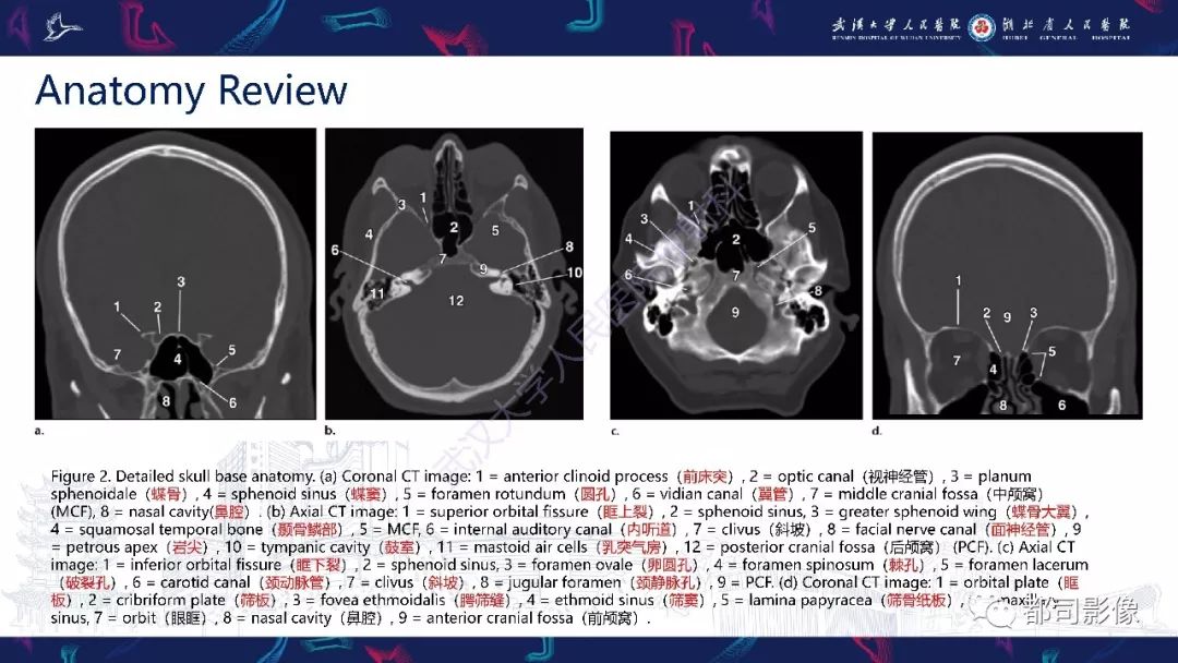 颅底急诊病变ct影像诊断