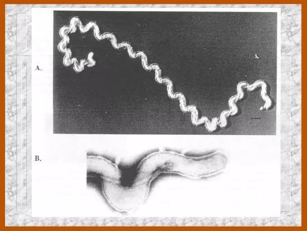 钩端螺旋体图片显微镜图片
