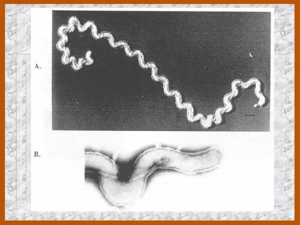 钩端螺旋体形态结构图片