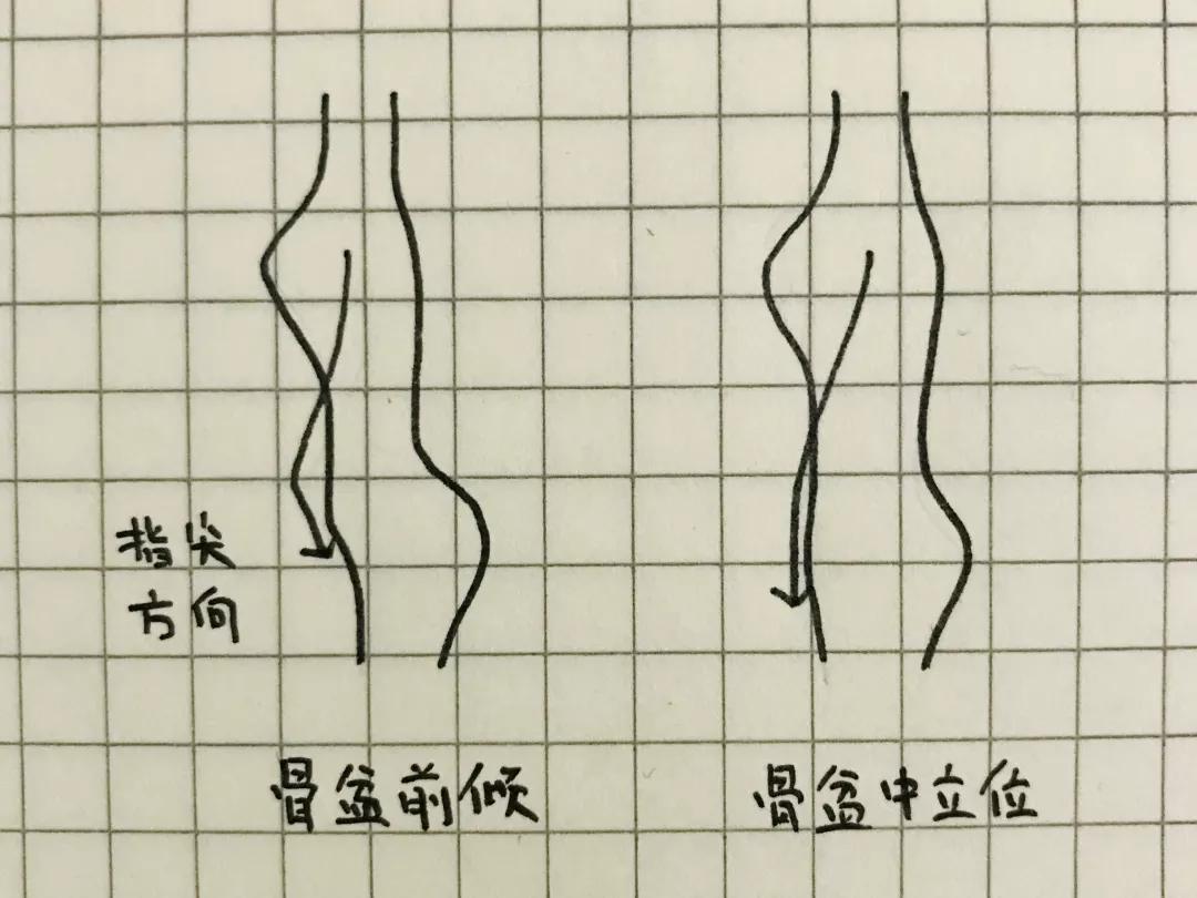 乾貨小腹突出是宮寒還是骨盆前傾