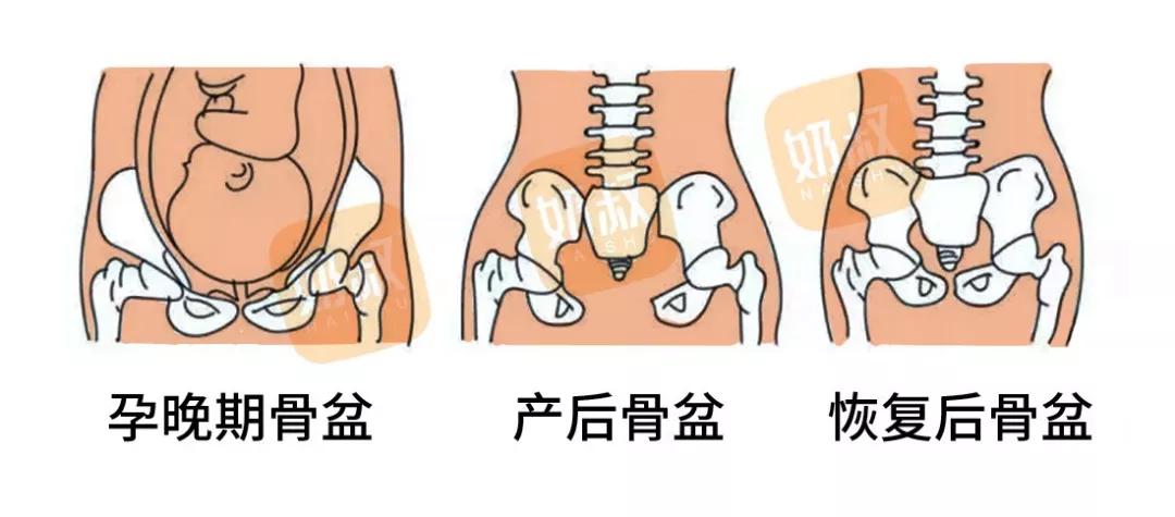 产前产后骨盆变化图片图片