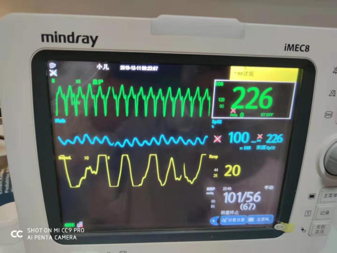 陈主任第一时间联系上心电图室吴旭燕主任,确诊"阵发性室上性心动过速