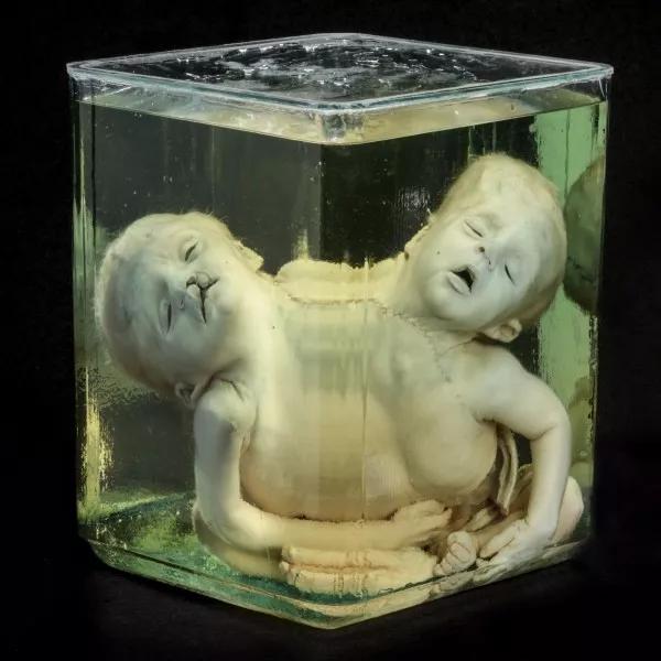 史上最重口味的博物馆充满最猎奇的藏品却最医者仁心